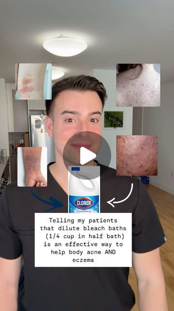 Dr Charles, MD | Health & Beauty Expert✨ on Instagram: "Body acne? Eczema? Cheap, dilute bleach baths can help…

Have you tried this? Would you? 

Derms LOVE bleach baths. 1/4 cup of regular (not extra strength) bleach into a half bath (always pour bleach into water and never bleach first into the tub). 

#skincare #acne #eczema #hacks #skin #doctor #lifehacks #dermatology #winter #fall 

*Please note that this post (like all of social media) is meant to entertain and educate. Never take anything you see on social media as direct medical advice. Always chat with your personal doctor before acting on anything you see on social media. Remember, even otc products and supplements are medicine! Many of these topics are oversimplified to make them more digestible. Context is everything!" Bleach Bath For Skin, Bleach Bath, Skin Doctor, Skincare Acne, Body Acne, Half Bath, Beauty Expert, Dermatology, Have You Tried