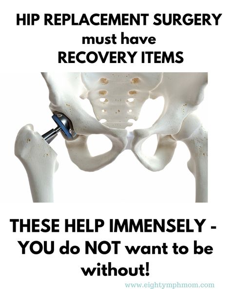 After Total Hip Replacement Surgery, I struggled with my recuperation after my joint replacement, as I didn't know about the things you need after hip replacement surgery. Now I know what to expect after hip replacement surgery and recovery after Anterior or Posterior hip replacement. I hope this list will help you too with your hip surgery. #THR #TLHR #TRHR #AnteriorHipReplacement #JointSurgerytips After Hip Surgery Care Package, How To Prepare For Hip Surgery, Preparing For Hip Surgery, Hip Exercises After Replacement, Total Hip Recovery, Total Hip Surgery, Hip Surgery Recovery Tips, Anterior Hip Surgery, Hip Surgery Recovery Humor