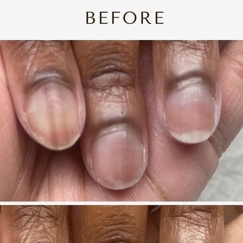 Jai on Instagram: "🚨 New Client Alert 🚨 

Take a look at this before and after… look at how much difference a manicure makes when it comes to having your nails done! Look at how much space we freed up on her nail plate by doing detailed cuticle work. 

S W I P E to see how we designed her nails 😍

♡⠀⠀⠀⠀⠀⠀⠀⠀⠀
♡⠀⠀⠀⠀⠀⠀⠀⠀⠀
♡⠀⠀⠀⠀⠀⠀⠀⠀⠀
♡⠀⠀⠀⠀⠀⠀⠀⠀⠀

#atxnails #atxnailtech #atxnailsalon  #nailtech #structuredgelmanicure #art #naturalnails  #fortcavazos #naildesigns #atxhairstylist #atxhair #pflugervilletexas #gelmanicure #pflugervilletx #pflugervillehairstylist #pflugervillelashes #austinstylist  #roundrocktx #georgetowntx #abstractnails #texasnails #roundrocknailtech #TheBrownJaiLing #austinnails #austinnailtech #shortnails
#abrowngirlwithanailbrush" Texas Nails, Georgetown Tx, Her Nails, Nails Done, Nail Plate, Gel Manicure, Nail Tech, How To Do Nails, Natural Nails