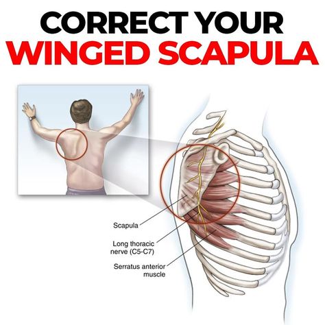 Winged Scapula Exercises, Scapula Exercises, Shoulder Blade Muscles, Winged Scapula, Punkty Spustowe, Serratus Anterior, Shoulder Pain Exercises, Neck And Shoulder Exercises, Shoulder Rehab