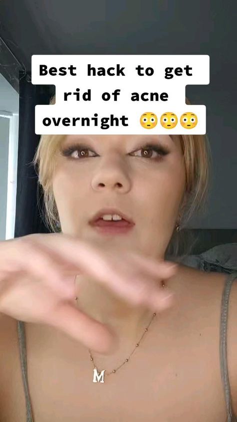 How to get rid of acne overnight #acne #beauty #pimple #facial #Wellness #HealthyLiving #NutritionTips #FitLife #FitnessTips #HealthTips #SelfCare #HealthyLifestyle Rid Of Acne Overnight, Get Rid Of Acne Overnight, Acne Beauty, Acne Overnight, Pimples Overnight, Pimples Remedies, Get Rid Of Acne, Rid Of Acne, Natural Acne Remedies