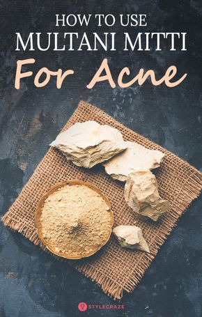 Multani Mitti Face Pack, Face Mapping Acne, Fullers Earth, Multani Mitti, Skincare Acne, Pimples Overnight, Acne Face Mask, Homemade Facials, How To Get Rid Of Pimples