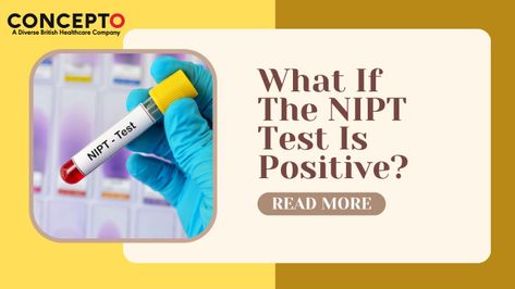 A positive nipt test in London may indicate potential genetic abnormalities. Therefore, go through this blog to learn about it. Nipt Test, Patau Syndrome, Edwards Syndrome, Chromosomal Abnormalities, Genetic Counseling, Medical Specialties, Positive Results, Baby Health, Prenatal