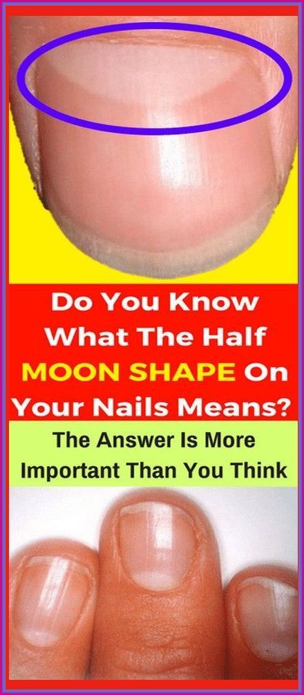 DO YOU KNOW WHAT THE HALF MOON SHAPE ON YOUR NAILS MEANS? ANSWER IS MORE IMPORTANT THAN YOU THINK! Half Moon Meaning, Nails Remedies, Moon Meaning, Layers Of The Epidermis, Tongue Health, Moon Nails, Slow Metabolism, Chicken Skin, Moon Shape