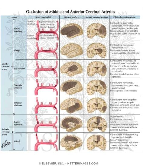 Occlusion of Middle and Anterior Cerebral Arteries Middle Cerebral Artery, Cerebral Arteries, Arteries Anatomy, Outdoors Quotes, Brain Surgeon, Quotes Celebrities, Brain Anatomy, Nursing School Survival, The Human Brain