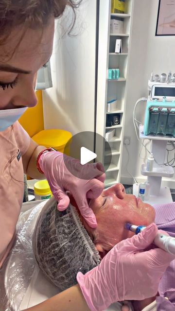 Arnica Aesthetics Clinic on Instagram: "✨Microneedling is a safe procedure that involves using a device with fine needles to create tiny punctures in the skin. 

These micro-injuries stimulate the body’s natural wound healing process, leading to increased collagen and elastin production. 

✨some benefits of microneedling include:1. Improved Skin Texture,2.Reduced Hyperpigmentation and Minimising the Pore Size in the skin.
#microneedling #microneedlingbeforeandafter #microneedlingtherapy #microneedlingtreatment #microneedlingfacial #microneedle #skinglow #aestheticsclinic #ａｅｓｔｈｅｔｉｃ #arnicaclinicleeds" Benefits Of Microneedling, Dermapen Microneedling, Aesthetics Clinic, Skin Aesthetics, Reduce Hyperpigmentation, Wound Healing, Improve Skin Texture, Healing Process, Skin Texture