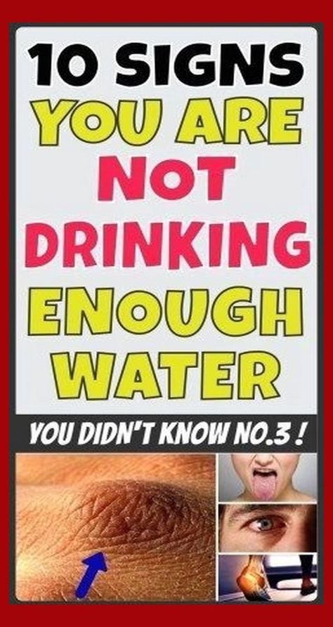 10 SIGNS YOU ARE NOT DRINKING ENOUGH WATER Drinking Enough Water, Not Drinking Enough Water, Diy Beauty Hacks, Natural Herbs, Natural Medicine, Herbal Remedies, Health Problems, Healthy Tips, Healthy Body