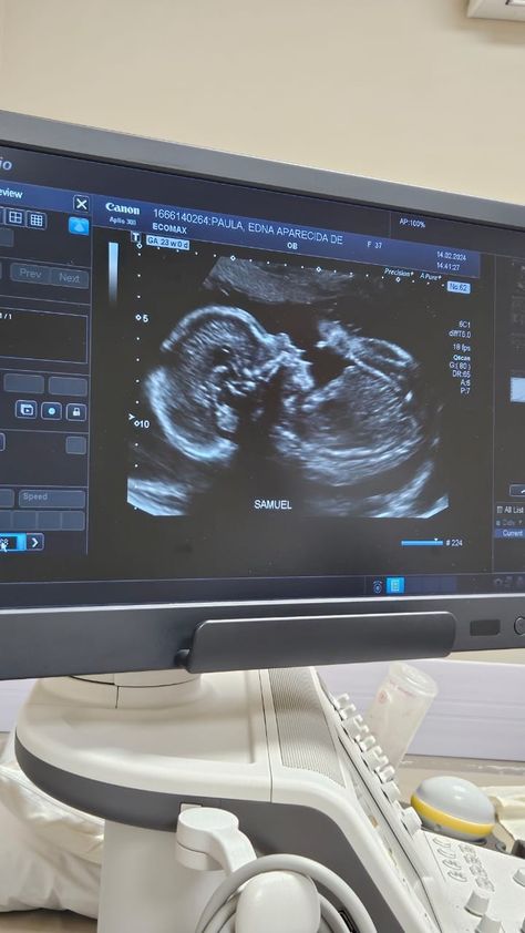 Hospital Delivery Room, Fake Ultrasound, Baby Sonogram, Sonogram Pictures, Belly Pics, Cute Pregnancy Pictures, Pregnancy Bump, Life Goals Future, Ultrasound Tech