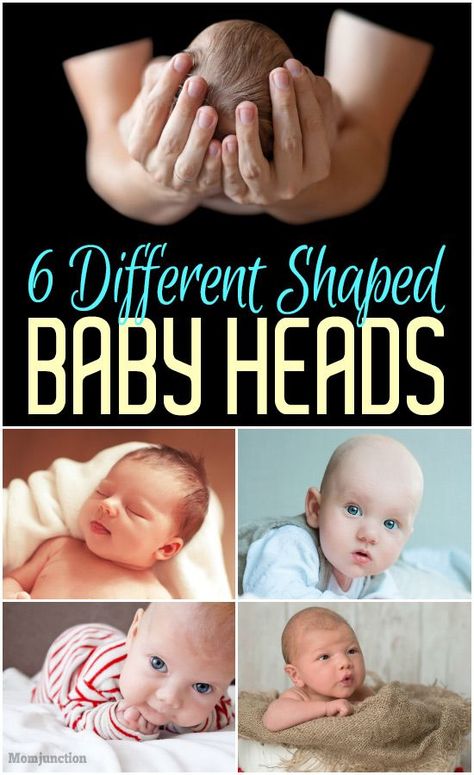 6 Different Shaped Baby Heads : If a baby’s appearance seems out of the ordinary, it can go two ways. It could either be a significant medical challenge or just a temporary birth-related malformation that subsides on its own. If the odd shape of a baby’s head is due to a medical diagnosis, it can be really hard on parents who find it difficult to handle. #newborn #newborns #babyheads #babies #babyhealth Baby Head Shape, Flat Head Baby, What Is Normal, Medical Diagnosis, Baby Boy Hairstyles, Babies First Year, Baby Sensory, Baby Development, Baby Coming