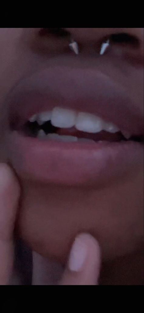 Sharp Canine Teeth Human Aesthetic, Canine Teeth Human, Canine Teeth Human Aesthetic, Sharp Teeth Reference, Natural Vampire Teeth, Sharp Canine Teeth Human, Natural Fangs Teeth, Teeth Fangs Natural, Bunny Teeth Smile