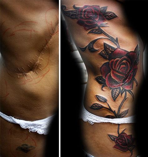 10  Amazing Tattoos That Turn Scars Into Works Of Art Tattoo Over Scar, Scar Cover Up, Coverup Tattoo, Tattoos To Cover Scars, Scar Tattoo, Inspiration Tattoos, Forearm Tattoo Women, Wrist Tattoos For Women, Tattoo Cover