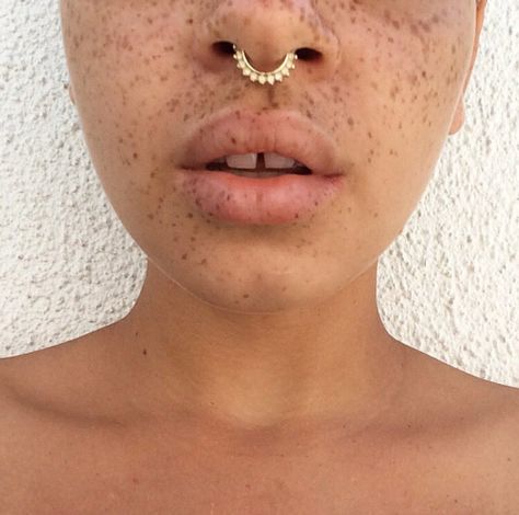 New post on vanish Teeth Gaps Aesthetic, Bull Nose Piercing, Hunk Garrett, Septum Piercing Jewelry, Gap Teeth, Austerity, Cute Piercings, Septum Jewelry, Goldfinch