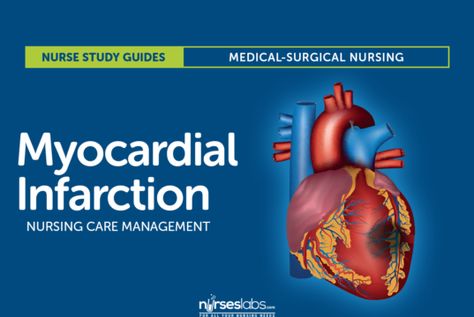 Myocardial Infarction Myocardial Ischemia, Cardiovascular Nursing, Acute Coronary Syndrome, Brain Surgeon, Nursing Study Guide, Nurse Manager, Care Management, Nursing Mnemonics, Nursing Care Plan