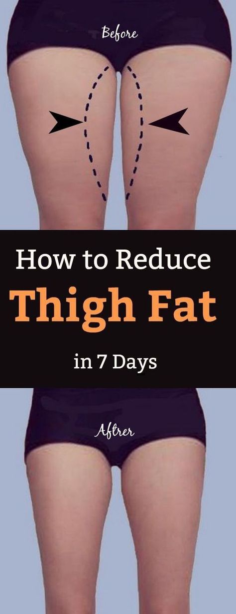 Have you tried thigh fat exercises and diet to get slim thighs and no results? Good news: Find out here how to lose weight in thighs in less than a week. Lose Thigh Fat Fast, Thigh Fat Workout, Shred Workout, Reduce Thigh Fat, Lose Thigh Fat, Intimate Wash, Remove Belly Fat, Thigh Fat, Thigh Exercises