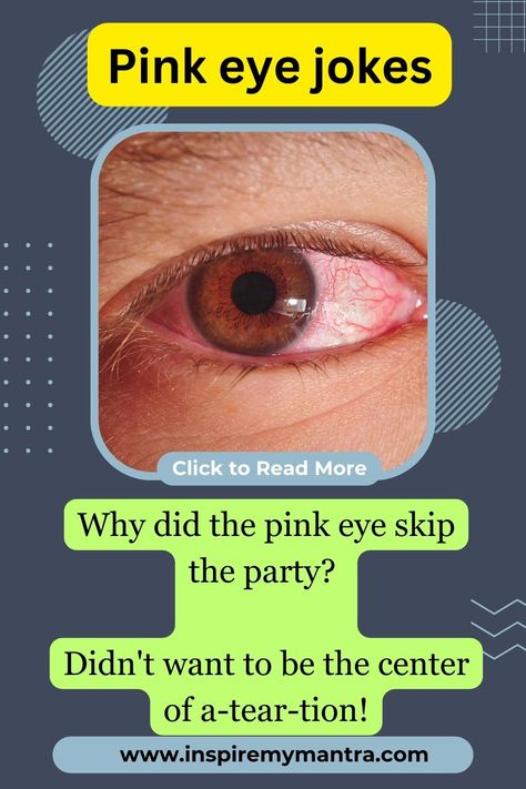 Best Pink Eye Jokes - See the Funny Side of Eye Infections Eye Jokes, Eye Infections, Hilarious Jokes, Pink Eye, Pink Eyes, The Funny, To Laugh, Funny Jokes, Good Things