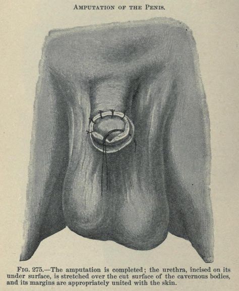 amputation procedures 1902 Abandoned Library, Surg Tech, Vintage Medical, Nursing Notes, Scientific Illustration, A Frog, Medical Technology, Medical History, How To Make Light