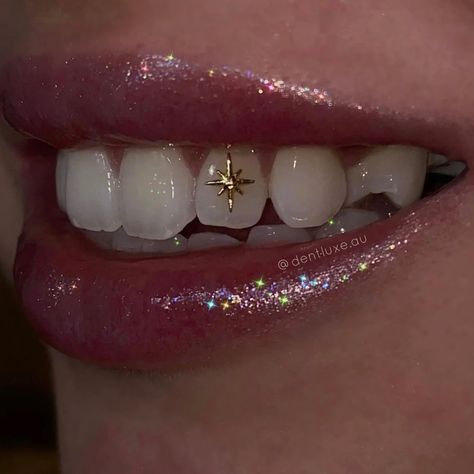 Pretty Teeth, Dental Jewelry, Gold Tooth, Grillz Teeth, Maquillage On Fleek, Diamond Teeth, Tooth Gems, Grills Teeth, Teeth Jewelry