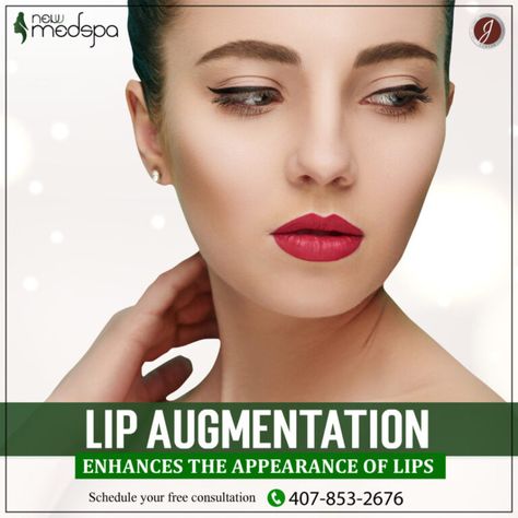 The most well-liked and efficient fillers are used by New U Med Spa to provide a variety of lip augmentation procedures. Our patients who want plumper, more defined lips frequently choose Juvederm, Restylane, and Volbella. These fillers have established themselves as secure and dependable methods of improving the volume and shape of the lips. With the addition of fullness to the lips, the hyaluronic acid-based filler Juvederm produces results that look natural. Dr J, Lip Augmentation, Injectables Fillers, Lip Filler, Lip Enhancement, Lip Fillers, Med Spa, Orlando Fl, Hyaluronic Acid