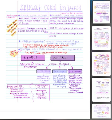 Here in this study guide bundle I cover Spinal Cord injuries including; primary/secondary spinal cord injuries, spinal cord injury signs/symptoms, complications, nursing interventions, diagnostics, labs, assessment, surgical options, and more! Feel free to message me for more details, pdf version/digital only, download available after purchase. Don't see your topic/disease/med covered? Message me and I can make a custom study guide/cheat sheet just for you and the topics of your choice! Spinal Cord Injuries Nursing, Spinal Cord Anatomy, Nursing Interventions, Nursing Ideas, Spinal Cord Injuries, Spinal Injury, Nursing Notes, Spinal Cord, Study Guides