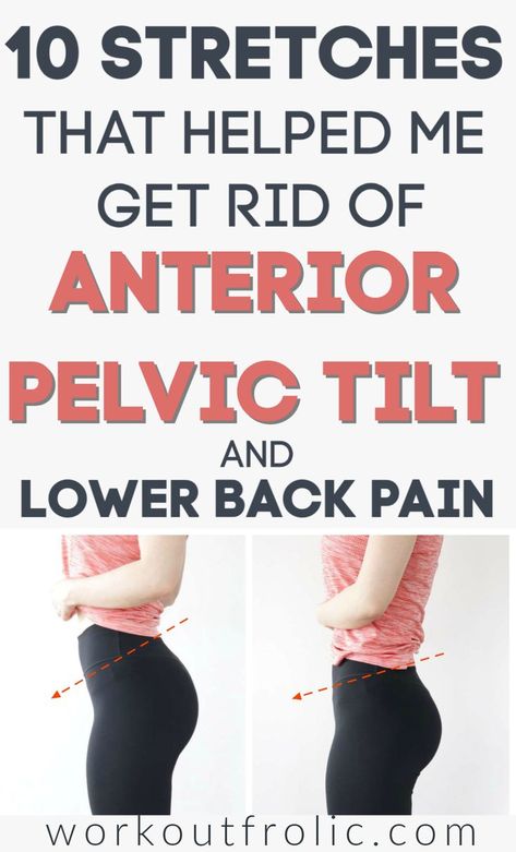 Anterior pelvic tilt - what's causing it and how to deal with it plus 10 simple stretching exercises to correct it and get rid of lower back pain for good! Pelvic Tilt, Stretch Routine, Lower Back Pain Exercises, Yoga Kurse, Relieve Back Pain, Back Pain Exercises, Stretching Exercises, Low Back Pain, Back Exercises