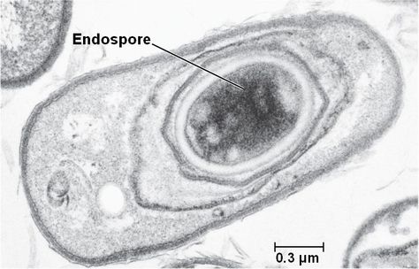 endospore in Bacillus anthracis Bacillus Anthracis, Microbiology Study, Under Microscope, Branches Of Science, Biology Science, Preventative Health, Microbiology, What Is Life About, Science And Nature