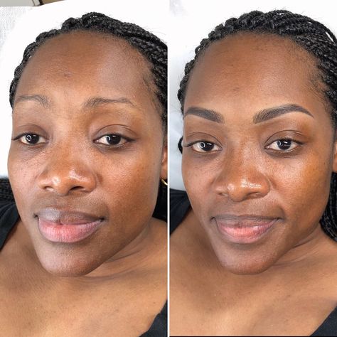 Microbladed Eyebrows Black Women, Microblading Combo Eyebrows, Microblading Eyebrows Black Women, Tattoo Eyebrows Before And After, Microblading Eyebrows Before And After, Brow Dye, Microbladed Eyebrows, Tattoo Brows, Permanent Eyebrow Tattoo