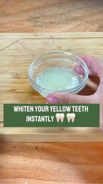 The Nature Recipe on Instagram: "Follow @thenaturerecipe for more recipes! Whiten your yellow teeth instantly 💯 #whiteteeth #healthyrecipe #recipe #toprecipe #remedies #homeremedies #thenaturerecipe" Natural Antibiotics For Tooth Infection, Yellow Teeth Remedy, Aloe Vera For Sunburn, Remedies For Dry Mouth, Pinkeye Remedies, Toothpaste Recipe, Home Remedies For Allergies, Home Remedies For Warts, Tooth Infection