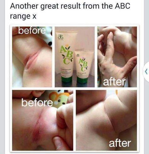 Arbonne ABC Baby Care Products.  Shop online at: http://luzmariaheredia.arbonne.com Anel Do Humor, Arbonne Skin Care, Postpartum Care Kit, Baby Care Products, Arbonne Products, Arbonne Consultant, Natural Anti Aging Skin Care, Arbonne Business, Organic Remedy