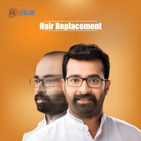 hair replacement Hair Transplant Creative Ads, Hair Transplant Ads, Hair Advertising, Hair Solution, Dental Posters, Hair Transplant Results, Hair Photography, Hair Clinic, Art Photography Portrait