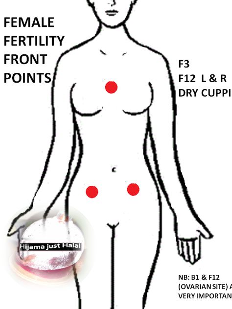 Front points female fertility Hijama Points, Cupping Points, Accupuncture Points, Fertility Acupuncture, Acupuncture Fertility, Reflexology Benefits, Benefits Of Cupping, Fertility Vitamins, Hijama Cupping