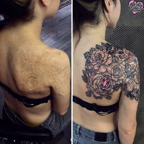 Scar Cover Up, Shoulder Blade Tattoo, Tattoos To Cover Scars, Blackwork Tattoos, Scar Tattoo, Tattoo Cover Up, Weird Tattoos, Tattoo Cover, Tattoo Cover-up