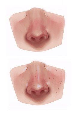 Nose Shading Reference, Manwha Art Style Reference, How To Paint Nose, Wet Skin Drawing, How To Color Skin Digital, How To Render Skin, How To Shade Skin, Shading Techniques Digital, Drawing Step By Step Easy