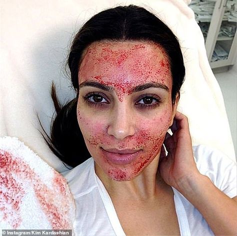 The One Day At A Time actress, 61, was makeup free with a very red face after getting a Vampire Facial, which was made popular by Kim Kardashian on Keeping Up with the Kardashians. Vampire Facial, Aesthetic Medicine, What’s Going On, Beauty Treatments, Funny Posts, Kim Kardashian, Funny Texts, Really Funny, Funny Jokes