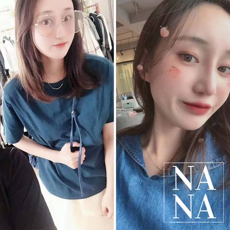 #nanahospital #plasticsurgeryclinic #cosmeticsurgery #cosmeticsurgeryinkorea #koreacosmeticsurgery #koreacosmeticsurgeryclinic #facialfatgrafting #zygomareduction #cheekbonereduction #jawreduction #facialcontouring #vline #slimface #ovalface #selfie #transformation Cheekbone Reduction, Facial Contouring Surgery, Nana Funny Face, Square Jaw, Meme Nana, Fat Grafting, Facial Contouring, Slimmer Face, Real Model