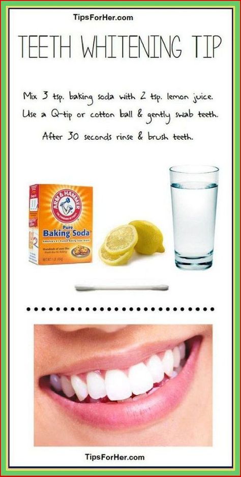 Naturally Whiten Teeth: 10 Ways To Remove Tartar Stains From Your Teeth Naturally Whiten Teeth, Teeth Remedies, Teeth Whitening Remedies, Whiten Teeth, Oral Care Routine, Gum Care, Natural Teeth Whitening, Natural Teeth, Oral Health Care