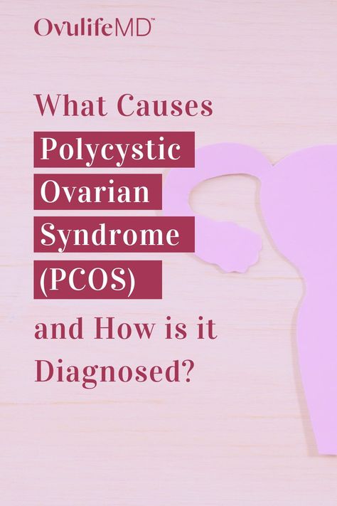 How is Polycystic Ovarian Syndrome (PCOS) Diagnosed? PCOS is a complex condition that impacts your fertility, metabolism, and mental health – all of which often go undiagnosed or unaddressed until women have difficulties trying to conceive. Read this post to understand how to accurately diagnose PCOS, PCOS causes, and other research-based information on PCOS. Polysistic Ovarian Syndrome, Cystic Ovarian Syndrome, Ttc Tips, Holistic Fertility, Fertility Yoga, Endocrine Disorders, Natural Fertility, Polycystic Ovarian Syndrome, Fertility Boost