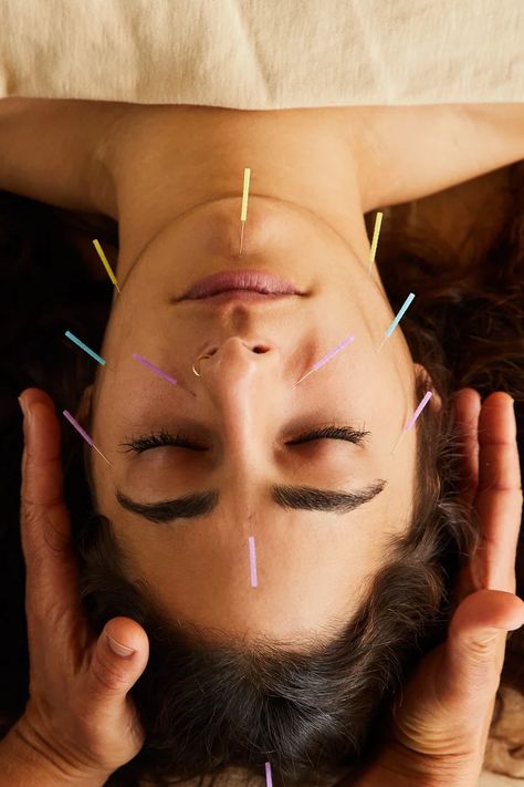 Cosmetic Acupuncture, Forward Head Posture Exercises, Facial Cupping, Natural Beauty Treatments, Forward Head Posture, Facial Rejuvenation, Acupuncture Points, Popsugar Beauty, Alternative Treatments