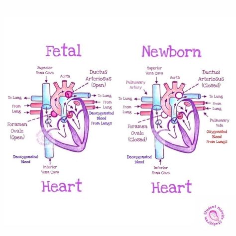 Diagnostic Medical Sonography Student Notes, Obgyn Medical Assistant, Sonography Student Notes, Nurse Midwife Student, Sonography Student Study Obgyn, Nicu Nurse Study Notes, Pediatric Cardiac Sonography, Nicu Nurse Notes, Midwifery Student Notes