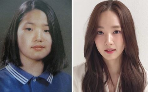 Kpop Idols Plastic Surgery Before And After, Celebrity Plastic Surgery Before After, Plastic Surgery Before And After, Kpop Plastic Surgery, Popular Korean Drama, Plastic Surgery Korea, Lim Ji Yeon, Korean Plastic Surgery, Sungkyunkwan Scandal