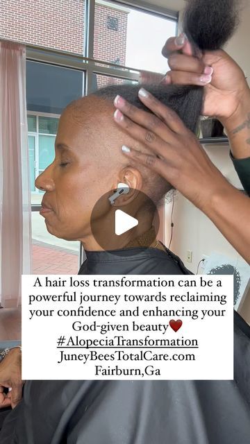 Bald Sides Hairstyles Black Women, Hairstyles For No Edges Black Women, Alopecia Ponytail Hairstyles, Braids For Alopecia For Black Women, No Edges Hairstyles Black Women, Alopecia Braid Styles, Alopecia Hairstyles Black Women, Hairstyles For Alopecia, Older Black Women Hairstyles Over 50