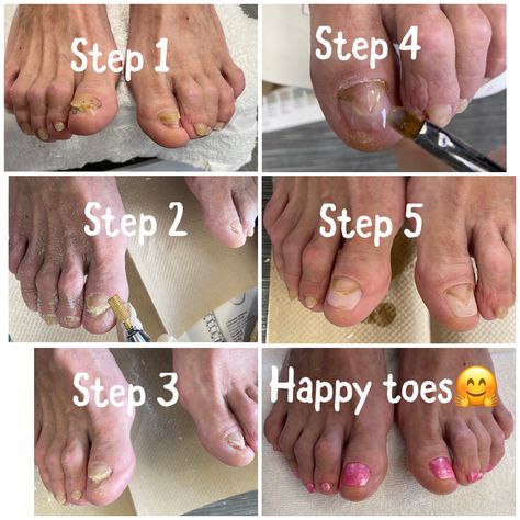 Builder Gel Toenails, Builder Gel, Nail Spa, Toe Nails, Make Up, Spa, Nails, Makeup