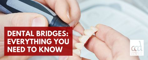 If you are missing teeth, you may be looking for an effective and permanent dental solution. Learn more about the types of dental bridges in our latest blog! Tooth Bridge, Dental Bridge Cost, Water Pick, Missing Tooth, False Teeth, Missing Teeth, Dental Bridge, Water Flosser, Dental Lab