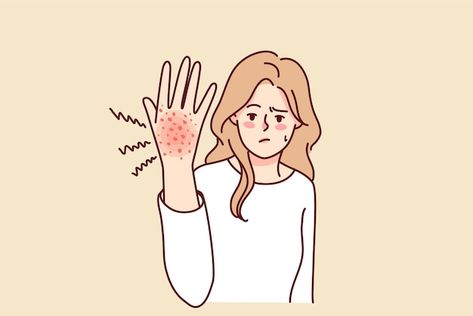 Skin Rashes, Diseases Illustration, Skin Rashes Pictures Types Of, Rash On Hands, Viral Rash, Common Skin Rashes, Fungal Rash, Diseases Pictures, Red Rash