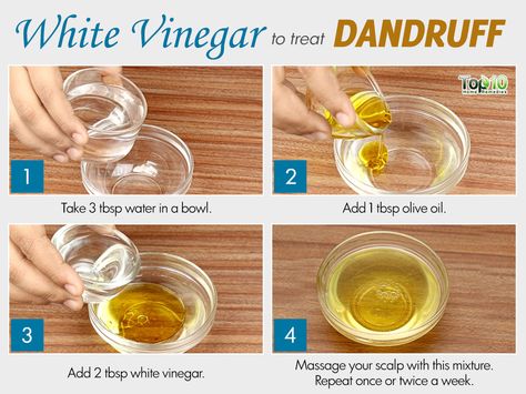 white vinegar for dandruff White Vinegar For Hair, Vinegar For Dandruff, Hair Mask For Dandruff, Dandruff Solutions, Home Remedies For Dandruff, Vinegar For Hair, Hair Recipes, Dandruff Remedy, Scalp Problems