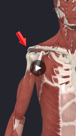 468K views · 5.6K reactions | 💥Pain in the Front of Your Shoulder?💥 (Full Shoulder Program on SALE today - Link in comments!...)
.
🔑Anterior (front) Shoulder pain can come from a few different things, but one common source is irritation of the long head of the biceps tendon. That's what I want to focus on today.
—-
➡️Biceps tendinopathy will present as pain along the front of the shoulder made worse by things like lifting the arm out in front of you, loaded pressing motions, and end range shoulder extension (like dips).
——-
😫This typically involves irritation of the long head biceps tendon as it crosses through a grove over the front of the shoulder.
——
✅To start with, it’s important to calm things down by avoiding aggravating movements, build up posterior shoulder strength, good scapu Biceps Tendinopathy, Focus On Today, Yoga Shoulder, Arm Exercise, Arm Bones, Big Shoulders, Shoulder Pain, What I Want, Arm Workout