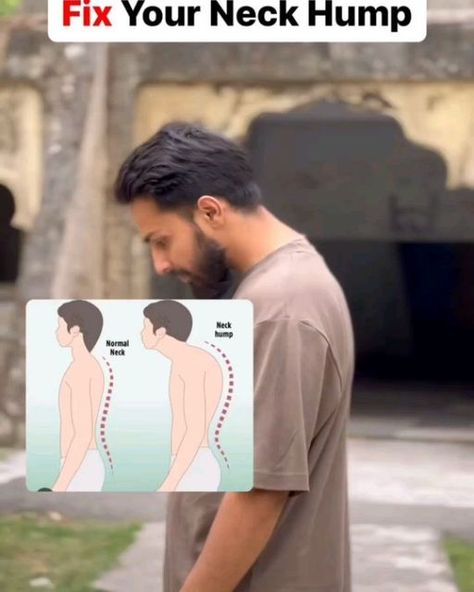 Back Pain | Neck Pain | Rehab on Instagram: "Exercises for neck hump, sciatica and lower back pain
.
.
Follow @endbackpain 
Follow @endbackpain 

By @rajatyogaworld 
.
.
.
.
#yoga #neckexercise #neckexercises #shoulderworkout #shoulders #shoulderpain 
#shouldermobility #mobility #neckpainrelief #neckpaintreatment #yogainspiration #painreliever #stiffneck #stiffness #yogaeverywhere #reelsinstagram #reels #reelkarofeelkaro #viralvideos #viralreels #trendingreels #trendingnow" Exercises For Neck, Neck Exercise, Forward Head Posture Exercises, Neck Hump, Rehab Exercises, Forward Head Posture, Lower Back Pain Exercises, Neck Exercises, Posture Exercises