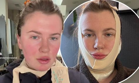 Ireland Baldwin explains why she underwent a mini facelift at age 26 Ireland Baldwin, Facelift Procedure, Cosmetic Procedures, Apple News, Daily Mail, Quick Saves