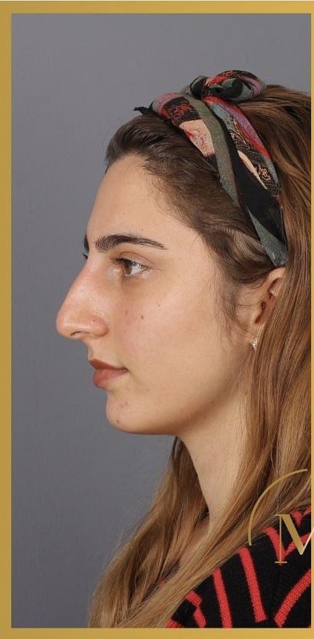 Side Profile Woman, Hooked Nose, Big Nose Beauty, Pretty Nose, Side Portrait, Face Profile, Nose Drawing, Clear Eyes, Female Profile