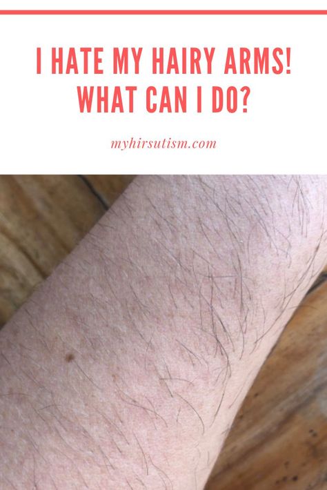 Hairy Arms? Here's what you can do to make them less noticeable and get rid of them forever! Shaving Tips Arms, Should I Shave My Arms, How To Shave Arm Hair, Arm Hair On Women, Waxing Arms, Ingrown Hair Remedies, Hair Removal Products, Girl Hacks, Hair Removal Diy