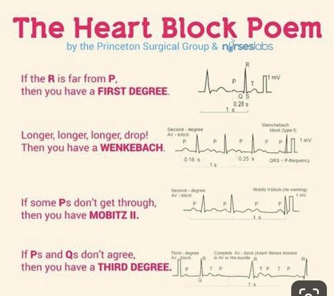 Ekg Interpretation, Ecg Interpretation, Paramedic School, Nursing Cheat, Nursing School Essential, Medical School Life, Nurse Study Notes, Nursing Mnemonics, Nursing Student Tips